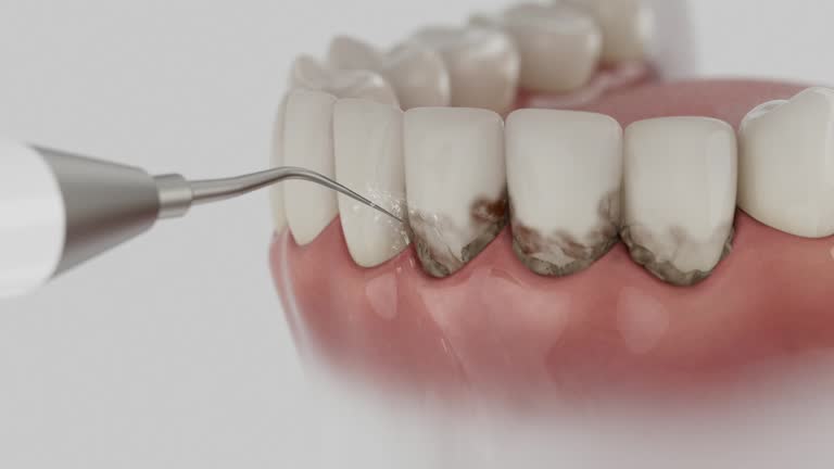 Trusted Emergency Dentist service in Burlington, VT - Dentist Open Now